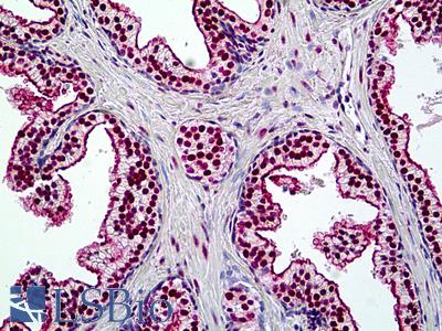 Anti-SMARCA4 / BRG1 antibody IHC of human prostate. Immunohistochemistry of formalin-fixed, paraffin-embedded tissue after heat-induced antigen retrieval. Antibody LS-B5107 concentration 3.75 ug/ml.