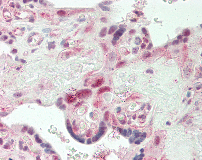 Human Placenta: Formalin-Fixed, Paraffin-Embedded (FFPE)