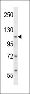 ISWI Antibody western blot of SK-BR-3 cell line lysates (35 ug/lane). The ISWI antibody detected the ISWI protein (arrow).