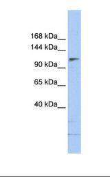 NTERA2 cell lysate. Antibody concentration: 1.0 ug/ml. Gel concentration: 6%-18%.