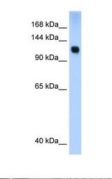 Transfected 293T cell lysate. Antibody concentration: 0.25 ug/ml. Gel concentration: 12%.