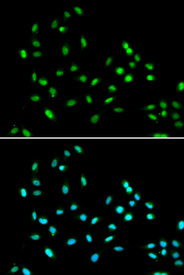 Immunofluorescence analysis of A549 cell using SMARCAD1 antibody. Blue: DAPI for nuclear staining.