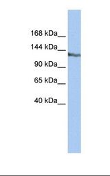 HepG2 cell lysate. Antibody concentration: 1.0 ug/ml. Gel concentration: 6-18%.