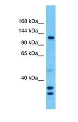 Western blot of SMARCAL1 Antibody with human Lymph Node Tumor lysate.