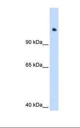 721_B cell lysate. Antibody concentration: 1.25 ug/ml. Gel concentration: 8%.