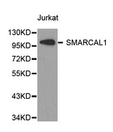 Western blot analysis of extracts of Jurkat cell line, using SMARCAL1 antibody.