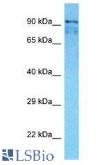 SMARCAL1 antibody Western Blot of PANC1. Antibody dilution: 1 ug/ml.