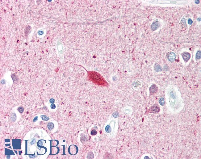Anti-SMARCAL1 antibody IHC of human brain, cortex. Immunohistochemistry of formalin-fixed, paraffin-embedded tissue after heat-induced antigen retrieval. Antibody LS-B423 concentration 5 ug/ml.