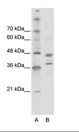 A: Marker, B: Jurkat Cell Lysate