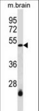 SMARCB1 Antibody western blot of mouse brain tissue lysates (35 ug/lane). The SMARCB1 antibody detected the SMARCB1 protein (arrow).