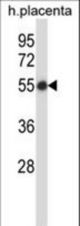 SMARCB1 Antibody western blot of human placenta tissue lysates (35 ug/lane). The SMARCB1 antibody detected the SMARCB1 protein (arrow).