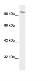 Jurkat Cell Lysate