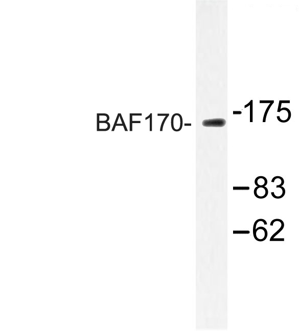 Western blot of BAF170 (M388) pAb in extracts from HUVEC cells.