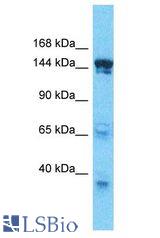 SMARCC2 antibody Western Blot of HepG2. Antibody dilution: 1 ug/ml.