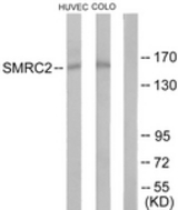 Western blot of extracts from HUVEC/COLO205 cells, using SMRC2 Antibody. The lane on the right is treated with the synthesized peptide.