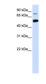 SMARCD1 antibody LS-C102766 Western blot of Fetal Liver lysate.