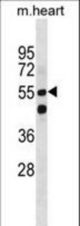 Mouse Smarcd1 Antibody western blot of mouse heart tissue lysates (35 ug/lane). The Mouse Smarcd1 antibody detected the Mouse Smarcd1 protein (arrow).