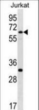 SMARCD1 Antibody western blot of Jurkat cell line lysates (35 ug/lane). The SMARCD1 antibody detected the SMARCD1 protein (arrow).