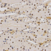 Immunohistochemistry of paraffin-embedded mouse kidney using SMARCE1 antibody at dilution of 1:200 (x400 lens)