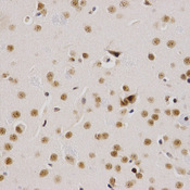 Immunohistochemistry of paraffin-embedded mouse brain using SMARCE1 antibody at dilution of 1:200 (x400 lens)