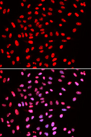 Immunofluorescence analysis of U2OS cell using SMARCE1 antibody. Blue: DAPI for nuclear staining.