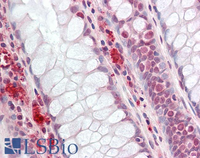 Human Colon: Formalin-Fixed, Paraffin-Embedded (FFPE)