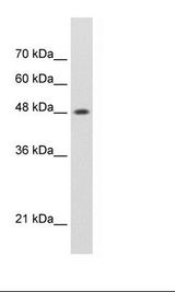 Jurkat Cell Lysate