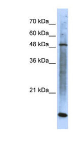 SMARCE1 antibody LS-C109772 Western blot of Transfected 293T cell lysate.