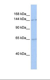 293T cell lysate. Antibody concentration: 1.0 ug/ml. Gel concentration: 6-18%.
