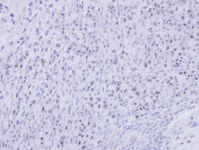 IHC of paraffin-embedded SAS xenograft using SMC1B antibody at 1:500 dilution.