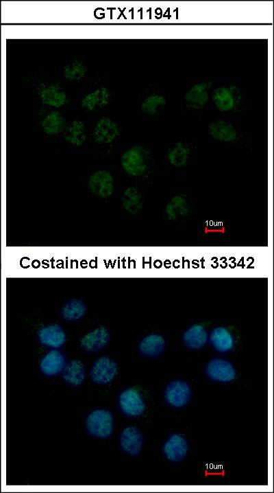 Immunofluorescence of paraformaldehyde-fixed A431 using SMC1B antibody at 1:500 dilution.