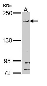 Sample (30 ug of whole cell lysate). A: Hela. 5% SDS PAGE. SMC1B antibody diluted at 1:1000.