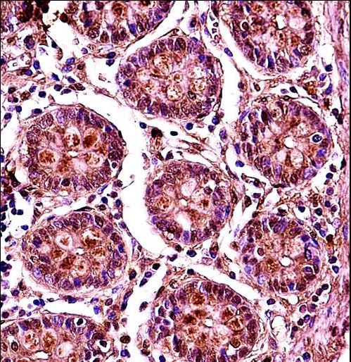 SMC1B Antibody immunohistochemistry of formalin-fixed and paraffin-embedded human colon tissue followed by peroxidase-conjugated secondary antibody and DAB staining.