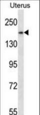 SMC1B Antibody western blot of human normal Uterus tissue lysates (35 ug/lane). The SMC1B antibody detected the SMC1B protein (arrow).