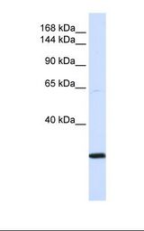 Transfected 293T cell lysate. Antibody concentration: 1.0 ug/ml. Gel concentration: 6-18%.