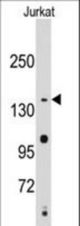 Western blot of anti-SMC2 Antibody in Jurkat cell line lysates (35 ug/lane). SMC2(arrow) was detected using the purified antibody.