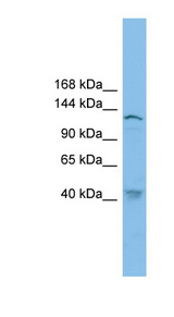 SMC3 antibody LS-C116339 Western blot of COLO205 cell lysate.