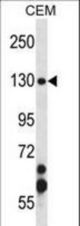 SMC3 Antibody western blot of CEM cell line lysates (35 ug/lane). The SMC3 antibody detected the SMC3 protein (arrow).