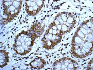 IHC of paraffin-embedded human colon tissue using anti-SMC3 antibody.