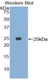 Western blot of recombinant SMC3 / HCAP.