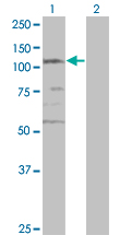Western blot of SMC3 expression in transfected 293T cell line by CSPG6 monoclonal antibody (M02), clone 2F11.