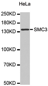 Western blot analysis of extracts of HeLa cell line, using SMC3 antibody.