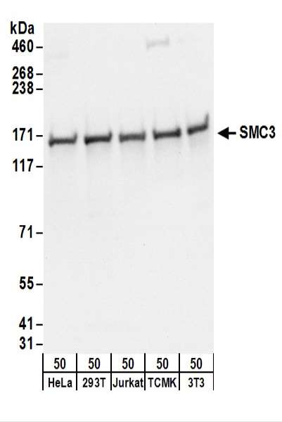 Detection of Human and Mouse SMC3 by Western Blot. Samples: Whole cell lysate (50 ug) from HeLa, 293T, Jurkat, mouse TCMK-1, and mouse NIH3T3 cells. Antibodies: Affinity purified rabbit anti-SMC3 antibody used for WB at 0.1 ug/ml. Detection: Chemiluminescence with an exposure time of 3 seconds.