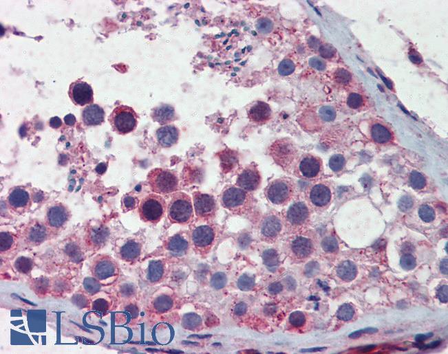 Anti-SMC3 antibody IHC of human testis. Immunohistochemistry of formalin-fixed, paraffin-embedded tissue after heat-induced antigen retrieval. Antibody LS-B5803 concentration 5 ug/ml.