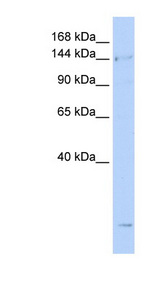SMC4 antibody LS-C111084 Western blot of Jurkat lysate.