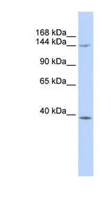SMC4 antibody LS-C111085 Western blot of MCF7 cell lysate.