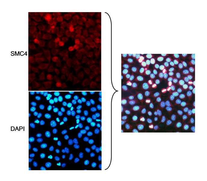 Localization of SMC4 to Mitotic Chromosomes by Immunofluorescence. Samples: HeLa cells grown on coverslips, fixed with methanol/acetone and blocked with 3% BSA in PBS. Antibody: Affinity purified rabbit anti-SMC4 antibody used at 5 ug/ml. Detection: Rhodamine labeled anti-rabbit secondary antibody. Cells were counterstained with DAPI.