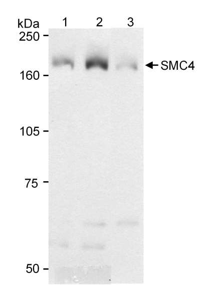Detection of Human SMC4 by Western Blot. Samples: Whole cell lysate (90 ug) from 293T cells (lane 1), SMC4 transfected 239T cells (lane 2) or normal human lymphoblasts (lane 3) separated on an 8% SDS-PAGE gel. Antibodies: Affinity purified rabbit anti-SMC4 used 0.2 ug/ml and goat anti-rabbit HRP used at a dilution of 1:20000. Detection: Chemiluminescence with 5 second.