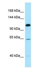 SMC6 antibody Western Blot of MCF7.