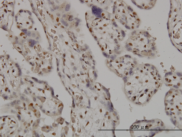 Immunoperoxidase of monoclonal antibody to SMC6L1 on formalin-fixed paraffin-embedded human placenta. [antibody concentration 3 ug/ml]